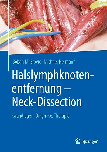 Halslymphknotenentfernung - Neck-Dissection: Grundlagen, Diagnostik, Therapie von Springer